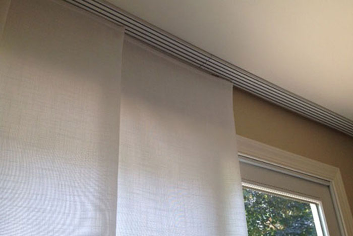 Ultrasonic Shade Cleaning-Before & After